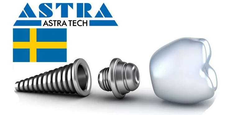 Импланты Astra TECH (Швеция)