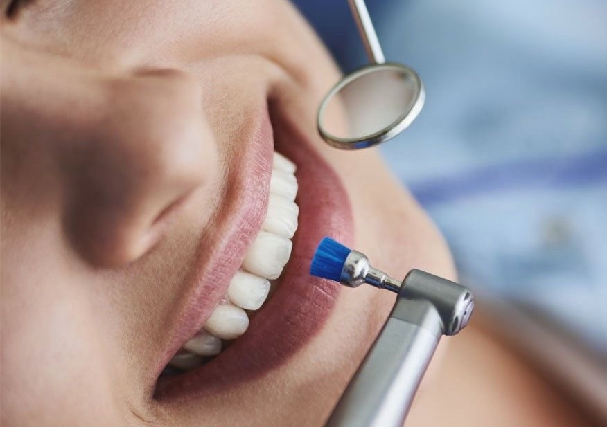 Профессиональная гигиена полости рта в ЦСС